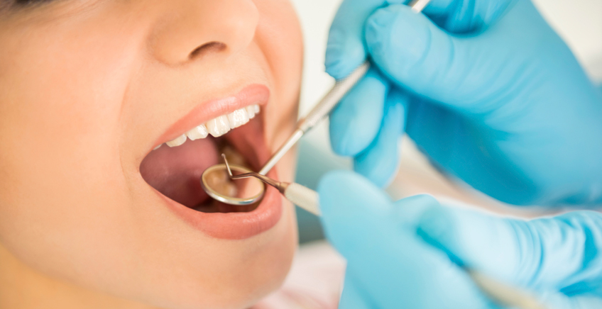 Get Rid of composite fillings Blue Springs Once and For All